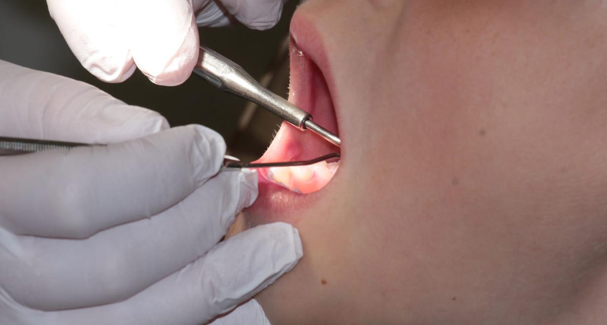 Assoziation mit Herz-Kreislauf-Erkrankungen immer eindeutiger – News – Deutsches Ärzteblatt