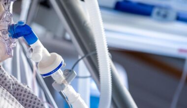 Höherer PEEP reduziert postoperative Lungenkomplikationen nicht – News – Deutsches Ärzteblatt