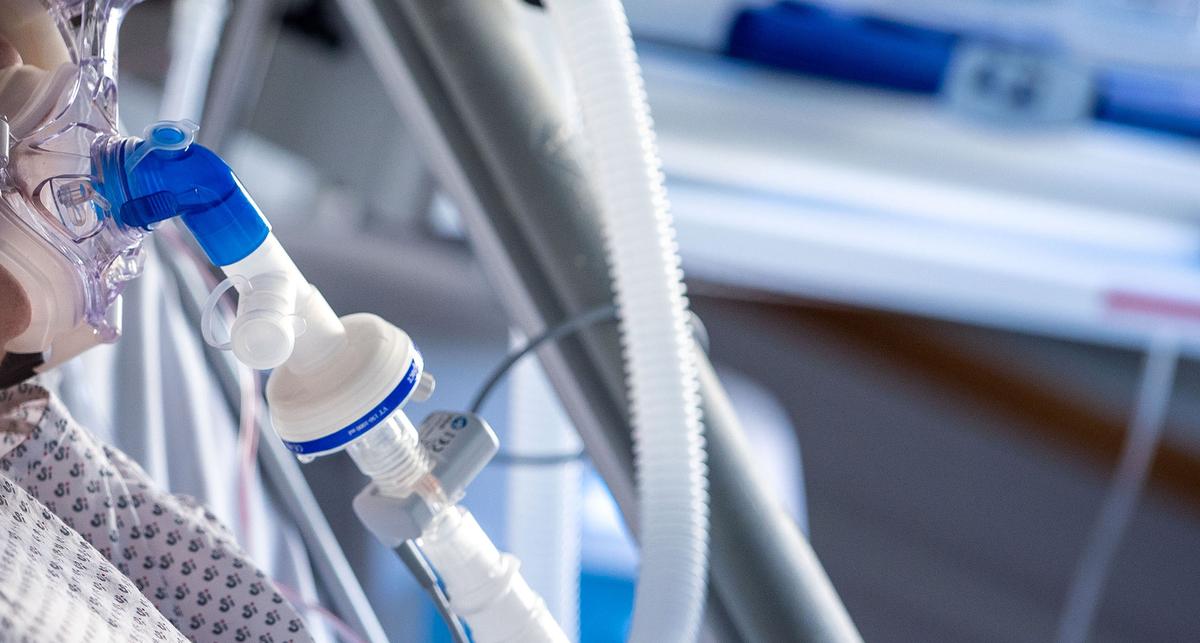 Höherer PEEP reduziert postoperative Lungenkomplikationen nicht – News – Deutsches Ärzteblatt