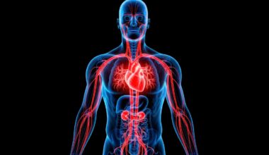 Wenn es um Komplikationen nach einer perkutanen Koronarintervention geht, stehen meist akute Blutungen z. B. durch eine Perforation im Fokus.