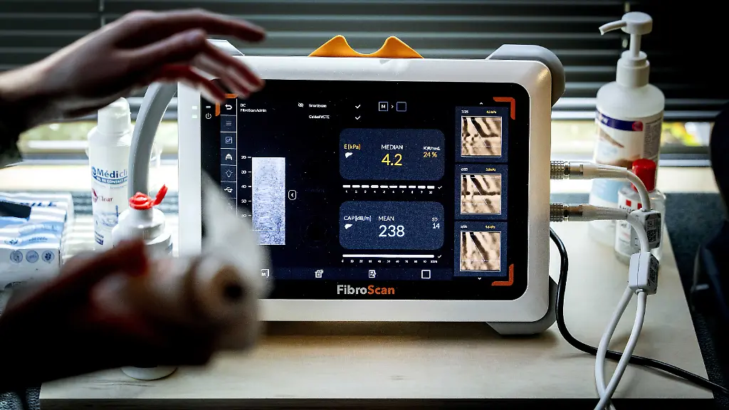 2025-05-07-11-19-49-AMSTERDAM-Eine-interessierte-Person-unterzieht-sich-wA-hrend-des-Kongresses-der-European-Association-for-the-Study-of-the-Liver-EASL-einem-Lebertest-WA-hrend-des-Kongresses-der-von-einer-medizinischen-Vereinigung-fA-r-Leberforschung-organisiert-wird-wird-der-Test-angeboten-um-das-Bewusstsein-fA-r-die-Gesundheit-der-Leber-zu-schA-rfen