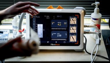 Google KI liefert Falschinformationen zu Leberwerten