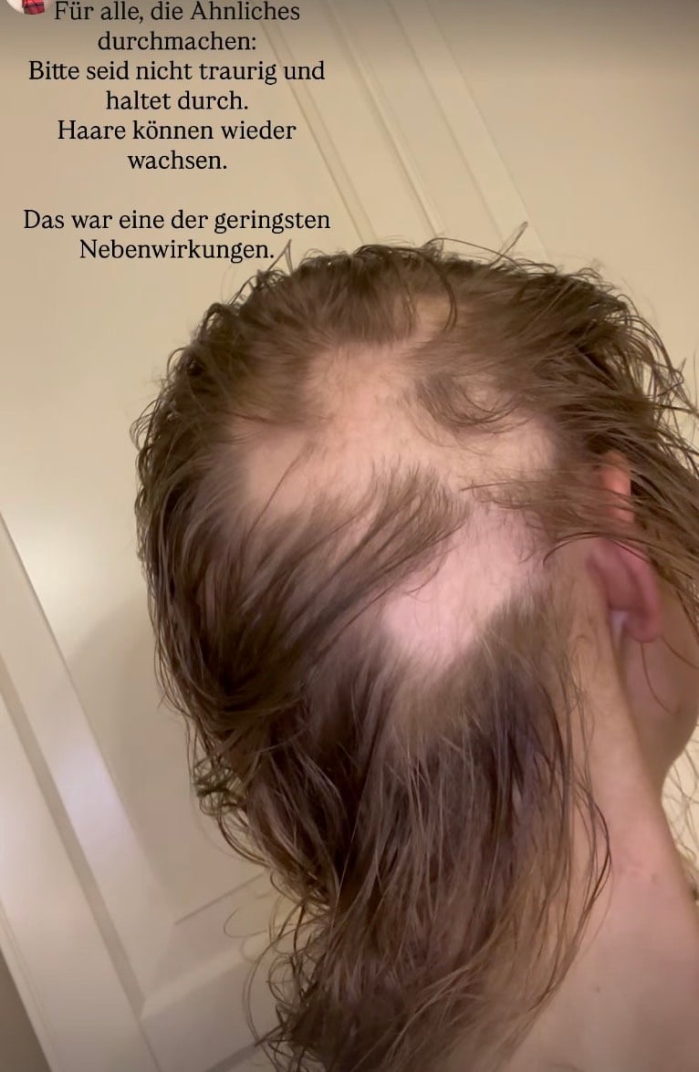 Dieses Foto teilte Patrice Aminati am Sonntagabend in ihrer Instagram-Story und macht vielen anderen Betroffenen damit Mut