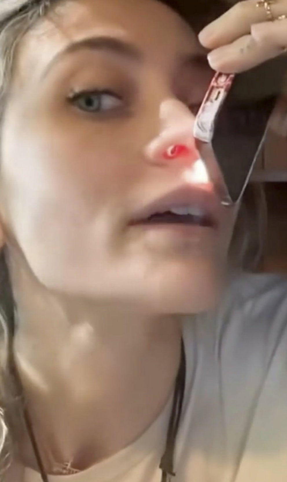 Sängerin und US-Schauspielerin Paris Jackson zeigte im November 2025 auf TikTok die Folgen ihres Drogenmissbrauchs – ein Loch in der Nasenscheidewand