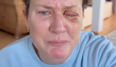 Silvester-Drama um beste Freundin von Vera Int-Veen: TV-Moderatorin böllert sich Auge weg | News