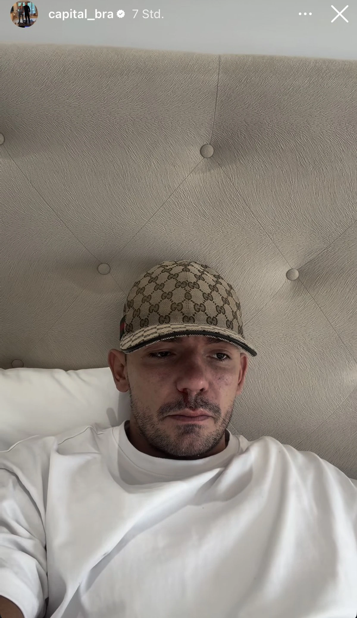 Capital Bra spricht über seine Sucht.