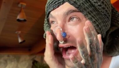 Face Icing: Bill Kaulitz probiert Beauty-Trend aus | Unterhaltung