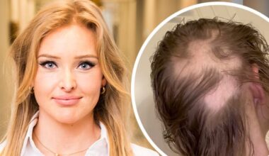 Krebskranke Patrice Aminati macht Betroffenen Mut: „Haare können wieder wachsen“ | Unterhaltung