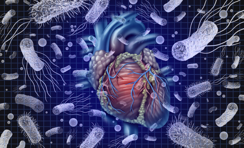 Verzögerter Antibiotikastart bei stabiler Endokarditis möglich