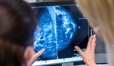 KI könnte Brustkrebsvorsorge verbessern – neue Studie