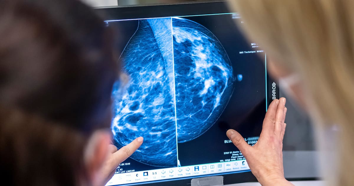 KI könnte Brustkrebsvorsorge verbessern – neue Studie
