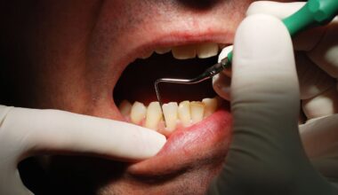 Zahnpasta gegen Parodontitis: Fraunhofer-Institut setzt auf gezielte Keimhemmung