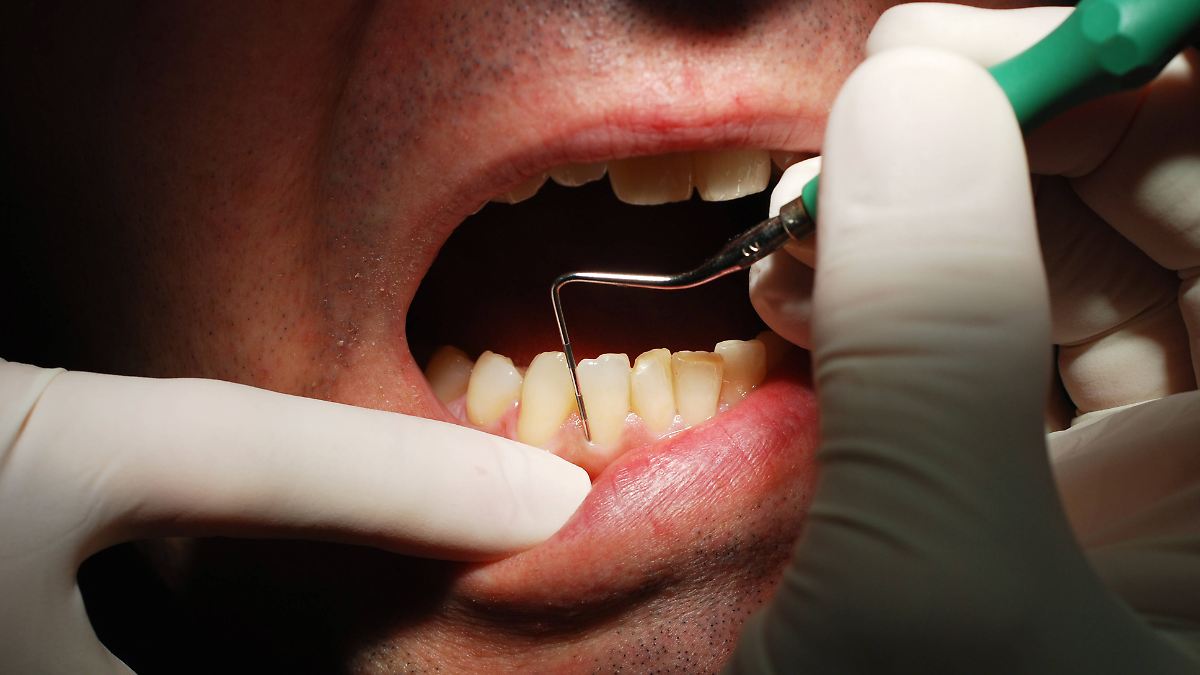 Zahnpasta gegen Parodontitis: Fraunhofer-Institut setzt auf gezielte Keimhemmung