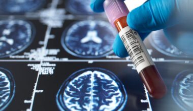 Andre Yarham: Jüngster Demenz-Patient Großbritanniens gestorben