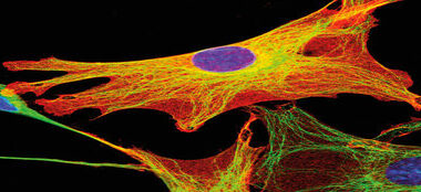 Fruktose befeuert Proliferation kolorektaler Tumorzellen