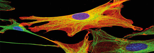 Fruktose befeuert Proliferation kolorektaler Tumorzellen