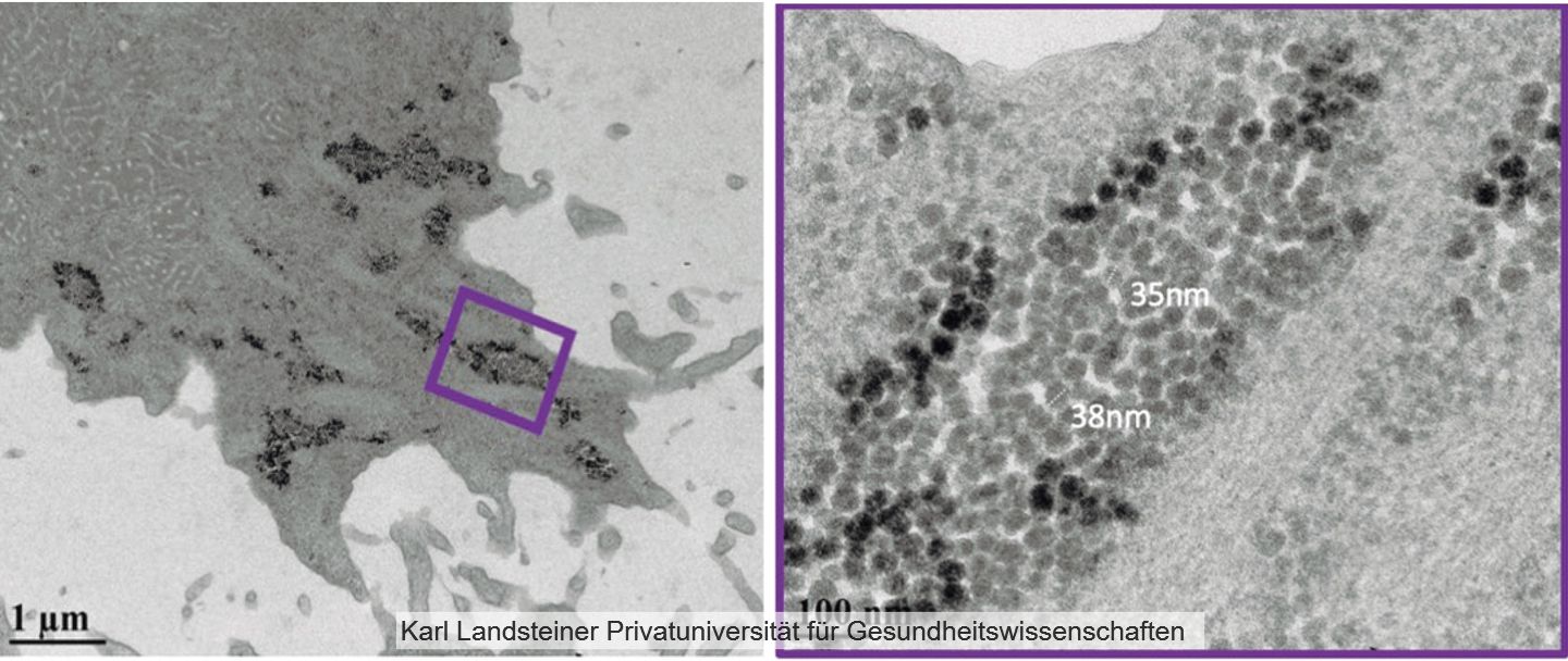 Amöben im Wasser als versteckte Reservoirs für Magen-Darm-Viren