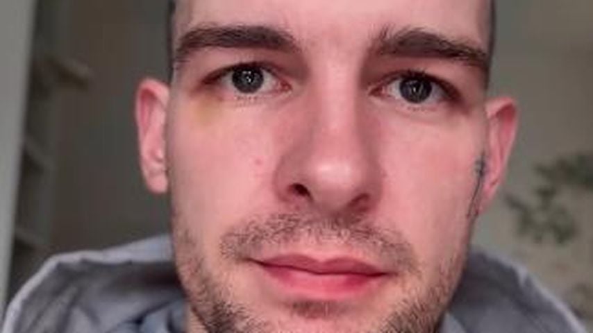 Eric Stehfest, TV-Bekanntheit