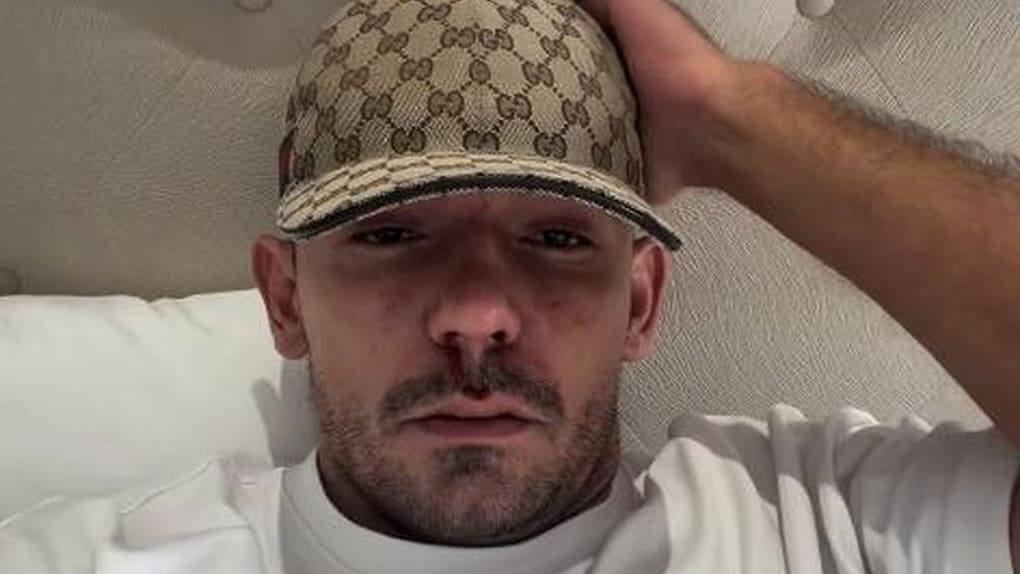 Capital Bra postet Video mit Blut an der Nase: Drogenrückfall beim Rapper | Unterhaltung