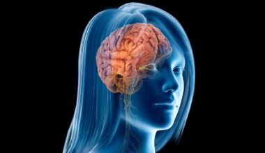 Demenz: Während der Wechseljahre verändert sich bei Frauen die Hirnstruktur ähnlich wie bei Alzheimer