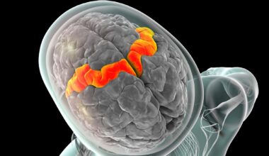 „Code geknackt“: Forscher entschlüsseln Gedanken mithilfe von Gehirn-Chip