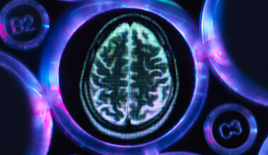 England: „Er muss einer der Jüngsten gewesen sein“ – 24-Jähriger stirbt an Demenz