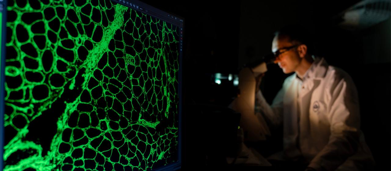 Ein klinischer Mitarbeiter untersucht Zellen aus einer Muskelbiopsie. | AP Ein klinischer Mitarbeiter untersucht Zellen aus einer Muskelbiopsie.