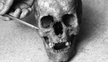 Ältester Nachweis des Syphilis-Erregers entdeckt - stuttgarter-zeitung.de