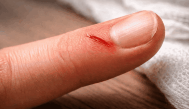 Leipziger Uniklinik erhält 7,5 Millionen Euro für deutschlandweites Projekt