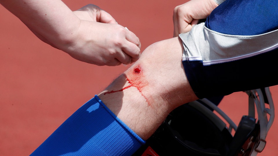 Jährlich Zehntausende Tote: Großprojekt soll Sepsis-Versorgung verbessern