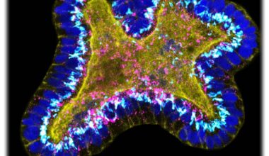 Aus Azinuszellen bestehendes Pankreas-Organoid. Abb.: Karolina Kuodyte, Rashmiparvathi Keshara u.a. für das MPI-CBG