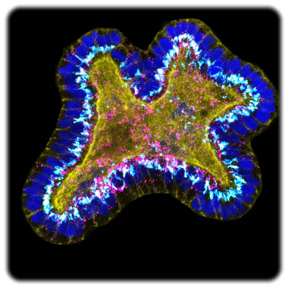Aus Azinuszellen bestehendes Pankreas-Organoid. Abb.: Karolina Kuodyte, Rashmiparvathi Keshara u.a. für das MPI-CBG