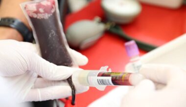 Blutspenden in Mönchengladbach gerade besonders knapp