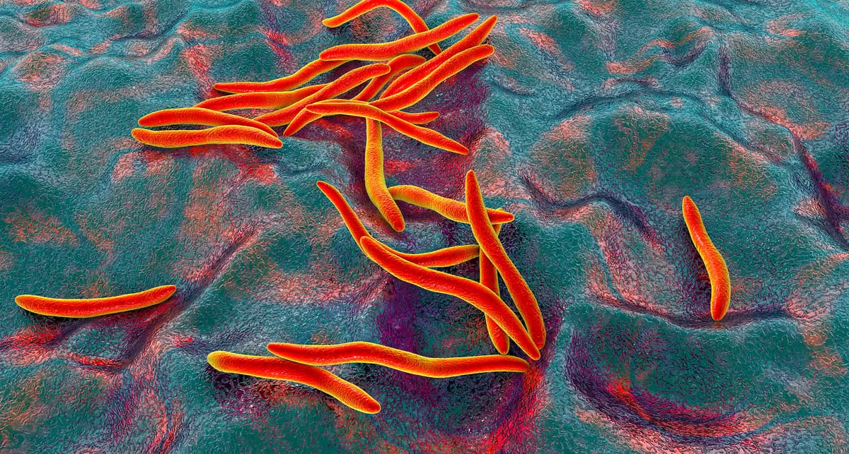 Fusobacterium nucleatum könnte Entstehung von Brustkrebs fördern – News – Deutsches Ärzteblatt