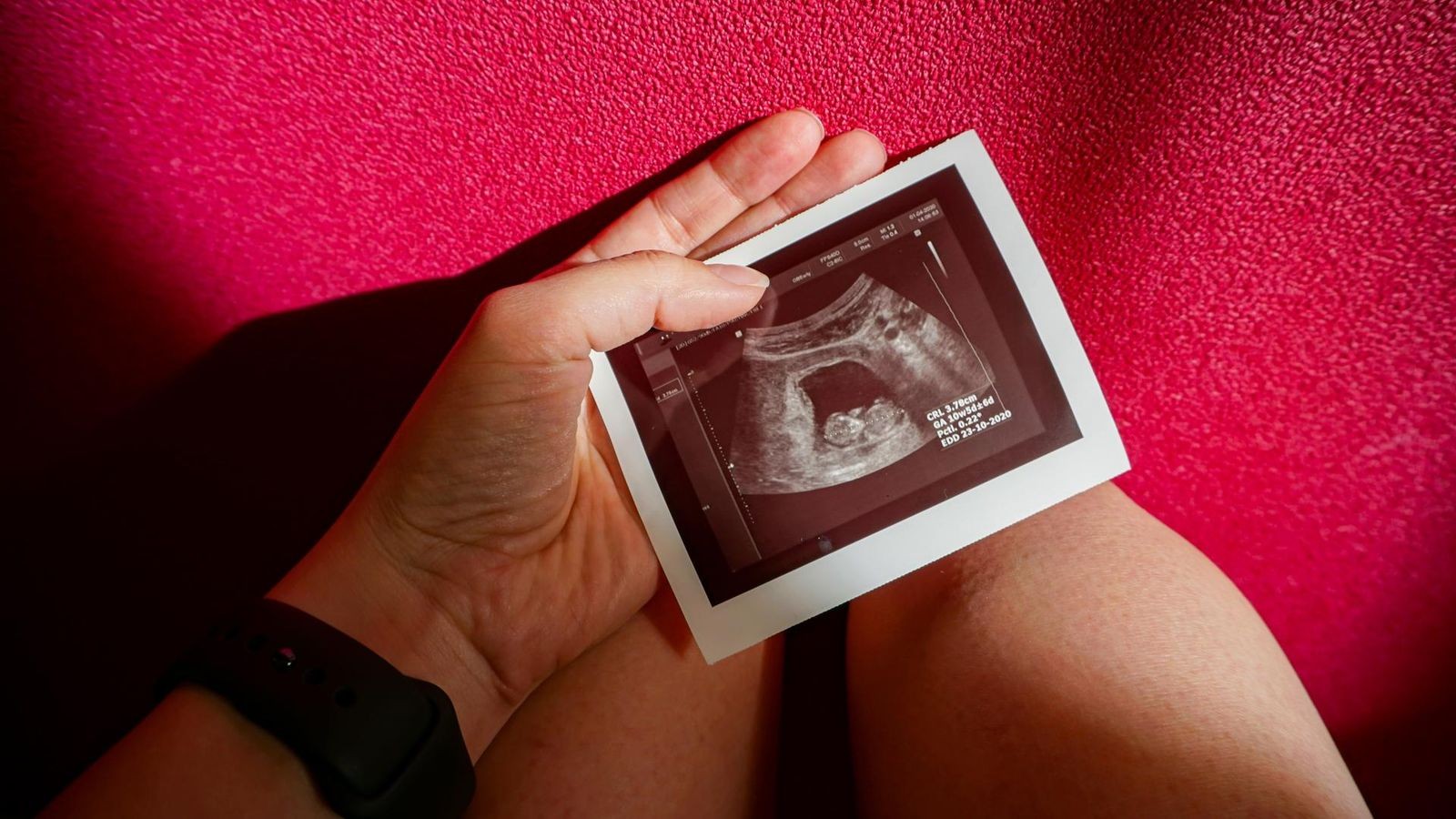 Gen-Varianten der Mutter beeinflussen Risiko – Was die Ursache ist