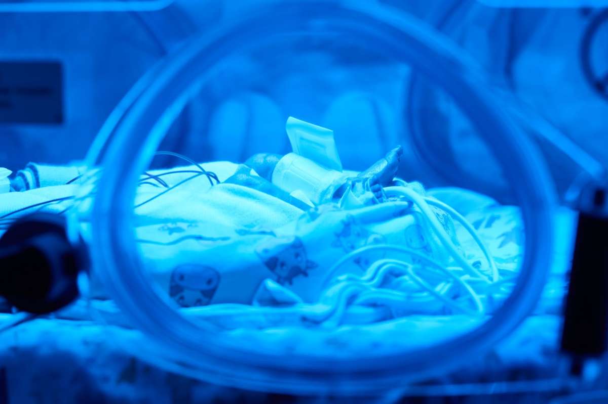 Gesundheit: Hoffnung für Frühchen: KI-Modellprojekt in Nürnberg startet - Bayern