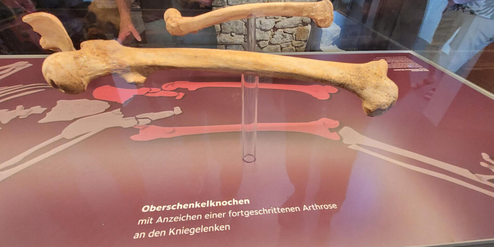 Skelett-Ausstellung in Nienborg: LWL sorgt für Enttäuschung