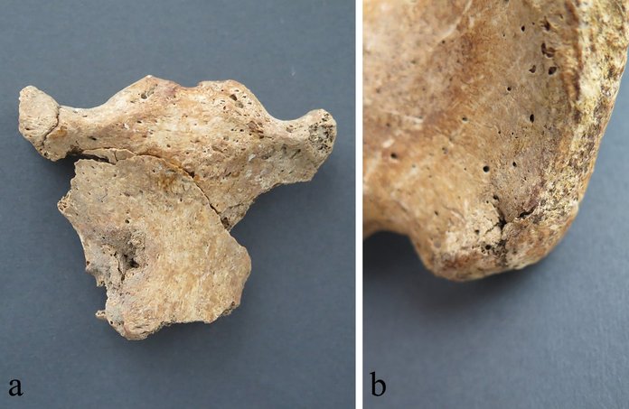 Kahelt skeletilt leiti torkehaavad