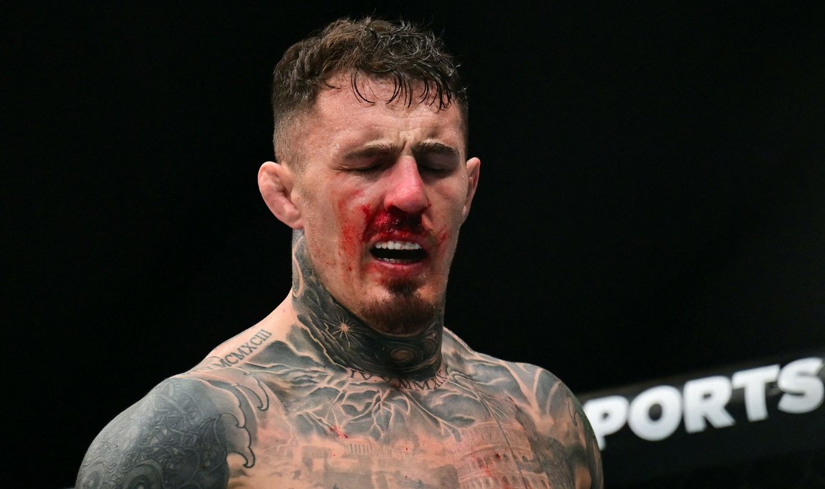 Tom Aspinallile torgati näpud silma ning seejärel ei olnud ta võimeline enam tiitlimatši jätkama