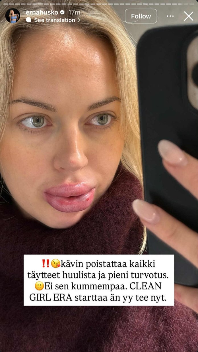 Kuvatõmmis Husko story'st