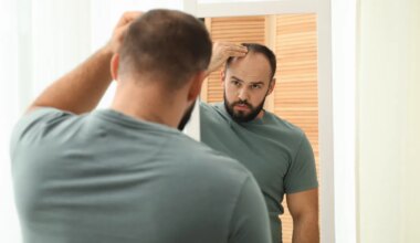 LÄBIMURRE!? ⟩ Pikaajaline kiilaspea võib tulevikus 20 päevaga juuksed tagasi saada