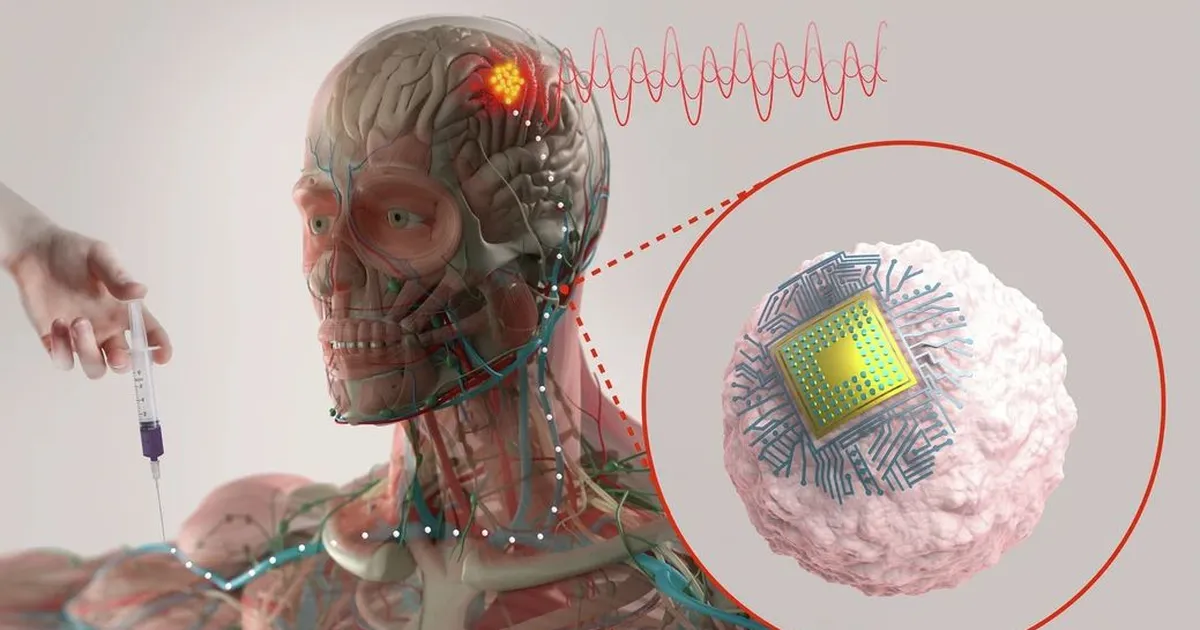 teadlaste uued küborg-verelibled liiguvad ajju seestpoolt