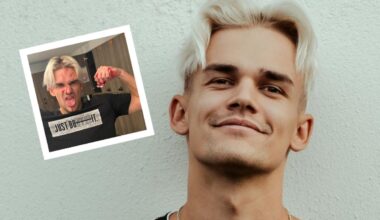 Muusik Rozell murdis padelit mängides ninaluu. „Lõin ise endale reketiga näkku“