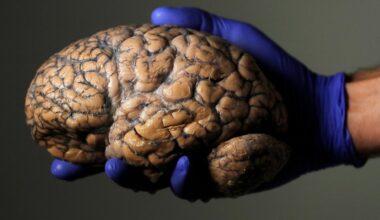 Noorus kestab 30. eluaastani. Uus uuring avastas inimese aju vanuselises arengus viis etappi