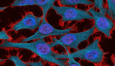 LÄBIMURRE VÄHIUURINGUTES ⟩ Selgus, miks vähirakud lõputult jagunevad