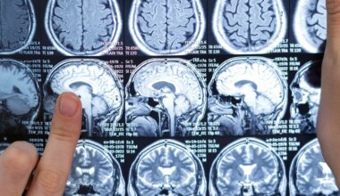 SUUR AVASTUS ⟩ Meie elu vältel oleks kolba sees justkui viis erinevat aju