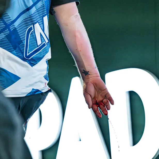 Cameron Menziese käsi oli verine.