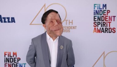 VAATA VIDEOT ⟩ Miks kardab haiguse tõttu «koletiseks» muutunud näitleja tehisaru?