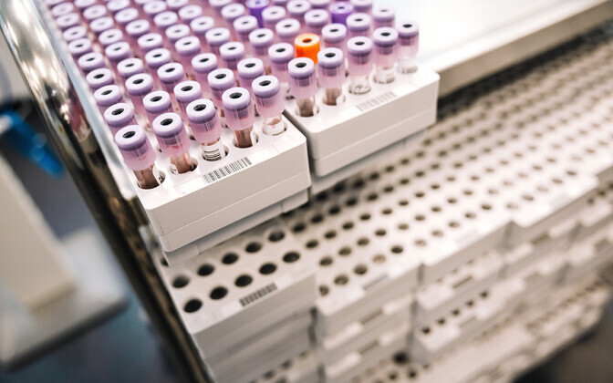 Laboriteenuste piirhinna kärpimine teeb haiglatele muret | Eesti