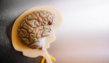 Nõdravõitu intellekt pälvib tehisaruajastul teenimatut tunnustust | R2 Portaal